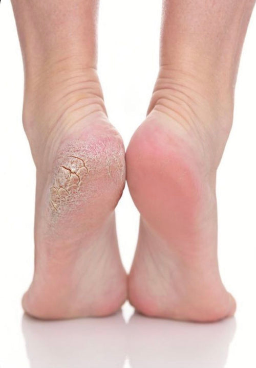 Beauté des pieds